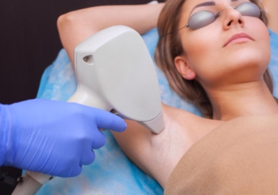 What Are The Benefits of Laser Hair Removal Treatment?
