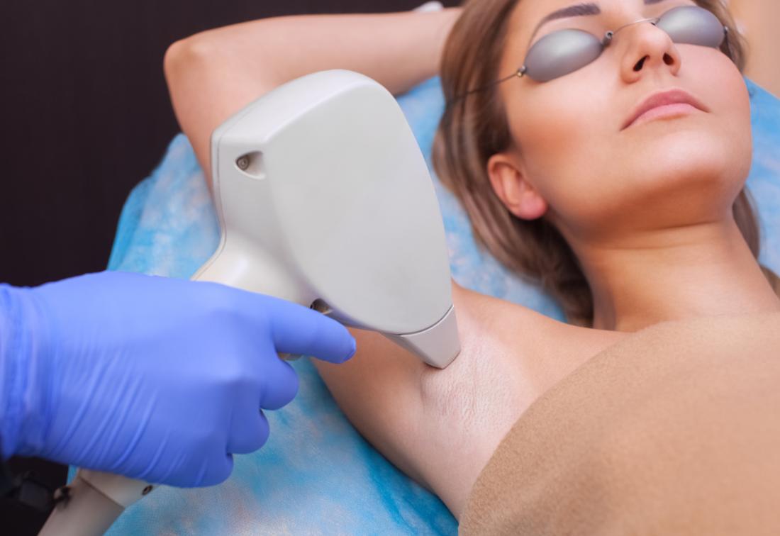 What Are The Benefits of Laser Hair Removal Treatment?